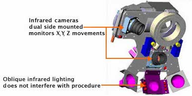 Diagram of the Visx ActiveTrak System - with dual infrared camerals to monitor eye movements.