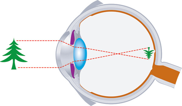 Chart showing how an eye sees